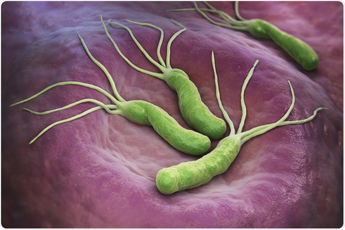 Hình vi khuẩn H pylori bám dính vào niêm mạc dạ dày ở người nhiễm vi khuẩn H pylori