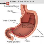 Một vài nguyên nhân hiếm gặp của hội chứng hẹp môn vị dạ dày