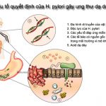 Vai trò của Helicobacter pylori trong ung thư dạ dày – Phần 1