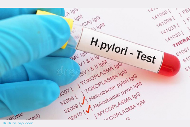 tác dụng men vi sinh với H. pylori